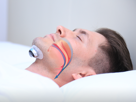 SnoozeFix Anti-Schnarch Gerät - Verbessern Sie Ihren Schlaf mit komfortabler Technologie