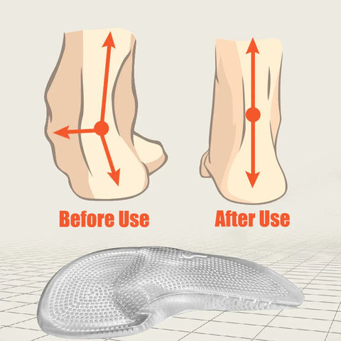 Silicon-Gel Orthopädische Einlegesohlen – Fußgewölbeunterstützung & Komfort