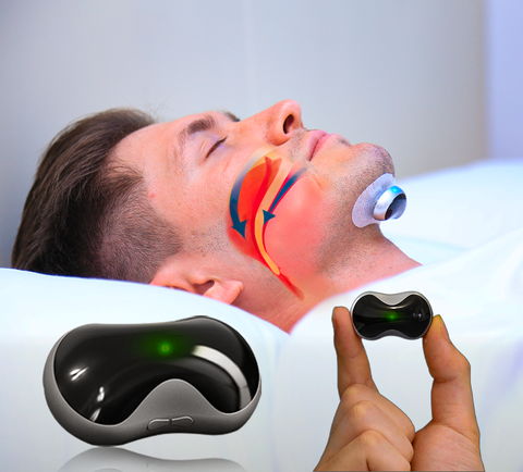 SnoozeFix Anti-Schnarch Gerät - Verbessern Sie Ihren Schlaf mit komfortabler Technologie